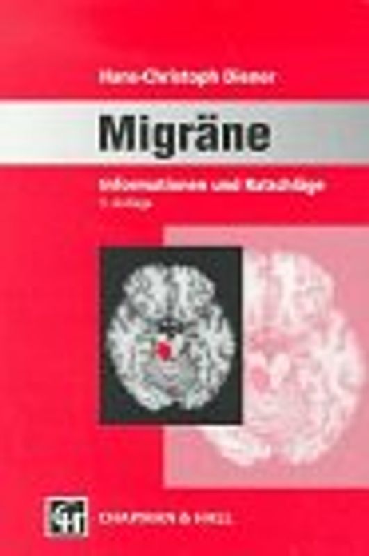 Migräne. Hinweise und Ratschläge