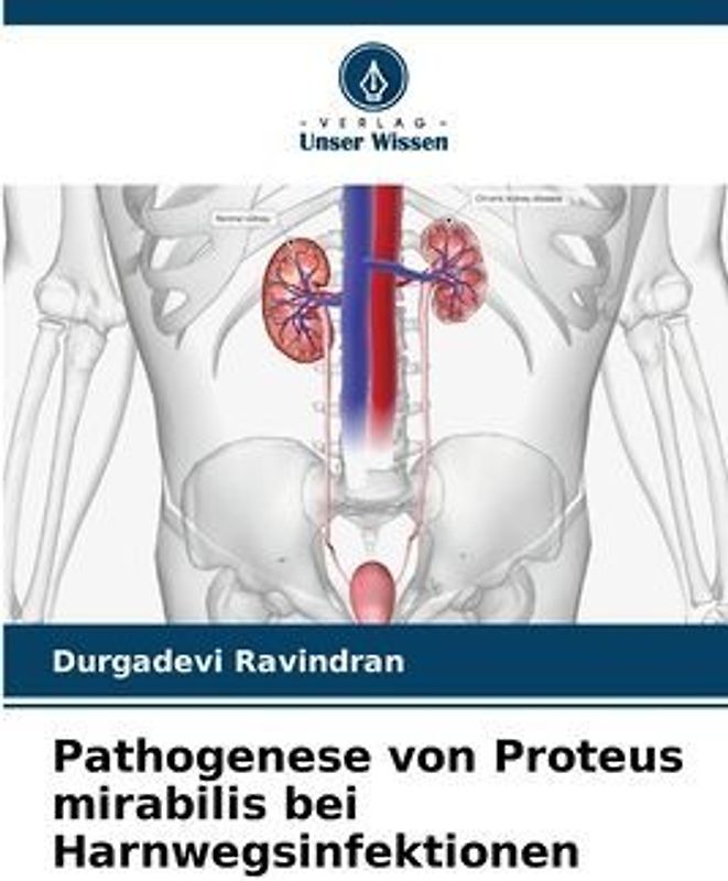 Pathogenese von Proteus mirabilis bei Harnwegsinfektionen