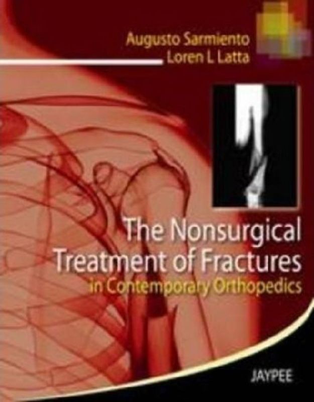 The Nonsurgical Treatment of Fractures in Contemporary Orthopedics