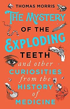 The Mystery of the Exploding Teeth and Other Curiosities from the History of Medicine