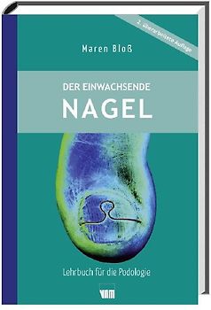Der einwachsende Nagel