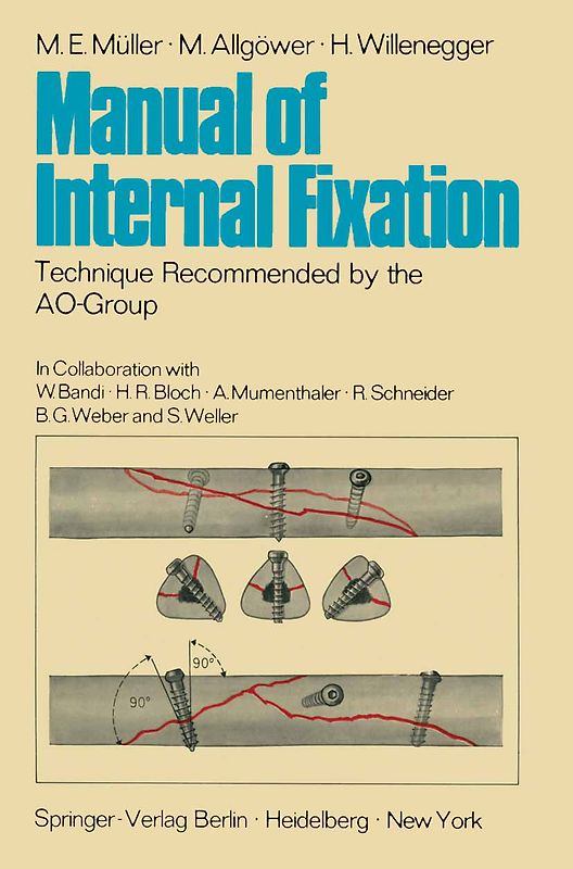Manual of Internal Fixation