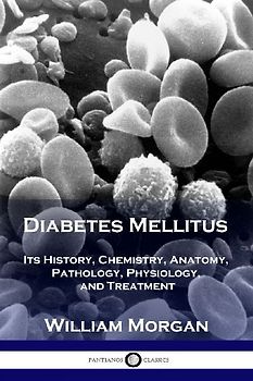 Diabetes Mellitus