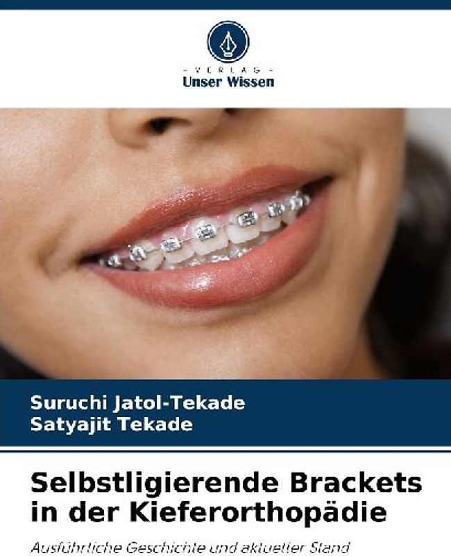 Selbstligierende Brackets in der Kieferorthopädie