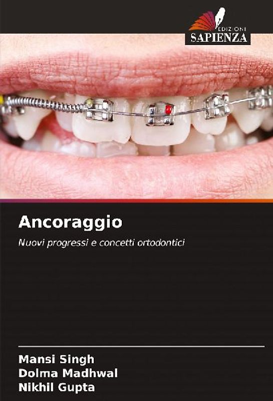 Ancoraggio