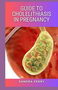 Guide to Cholelithiasis in Pregnancy: Cholelithiasis is typically not characterized by any signs or symptoms, unless there is an obstruction of the cystic duct, bile ducts, or both.
