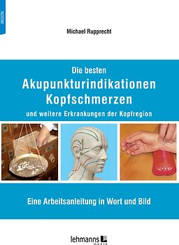 Die besten Akupunkturindikationen Kopfschmerzen und weitere Erkrankungen der Kopfregion