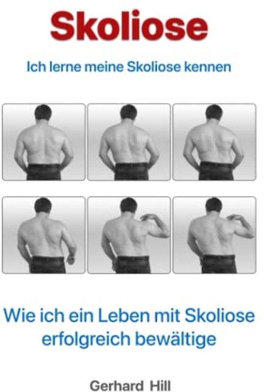 Skoliose: Ich lerne meine Skoliose kennen