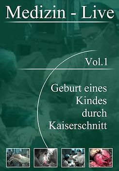 Medizin Live, Vol. 01 - Geburt eines Kindes durch Kaiserschnitt DVD