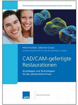 CAD/CAM-gefertigte Restaurationen