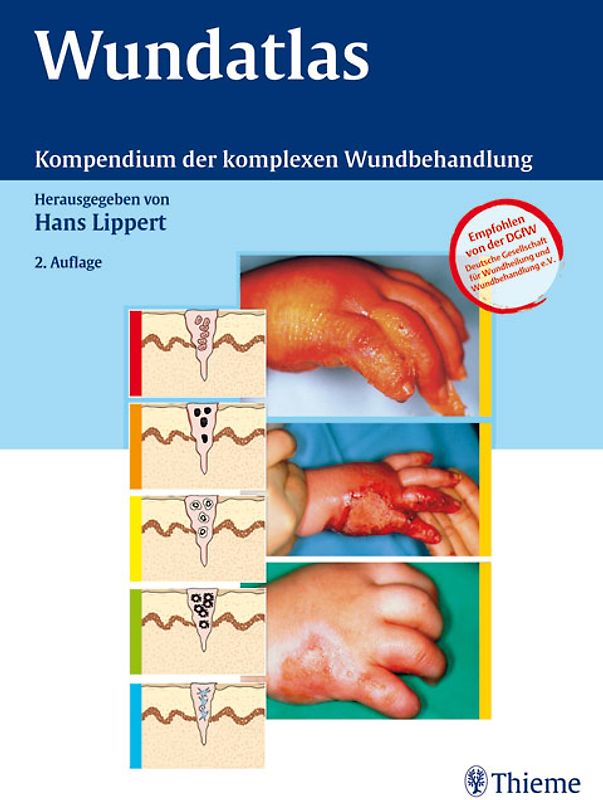 Wundatlas