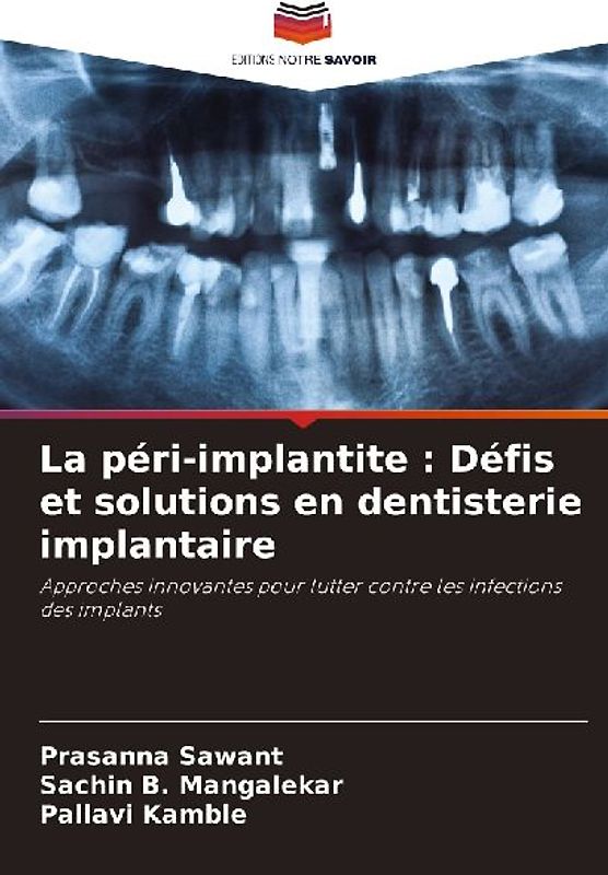 La péri-implantite : Défis et solutions en dentisterie implantaire