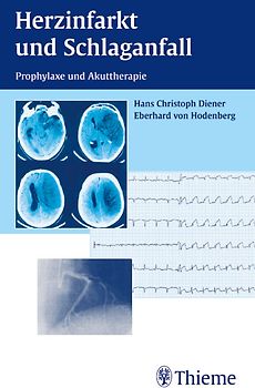 Herzinfarkt und Schlaganfall. Prophylaxe und Akuttherapie