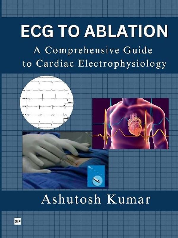 ECG TO ABLATION