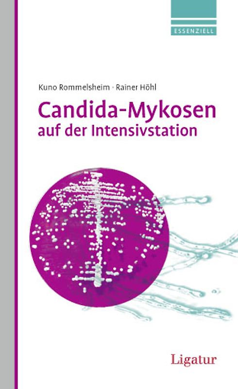 Candida-Mykosen auf der Intensivstation